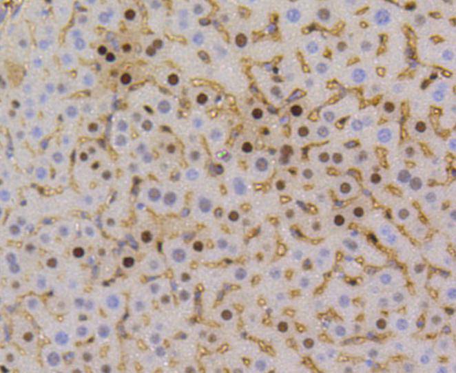 Cyclin D1 Rabbit mAb