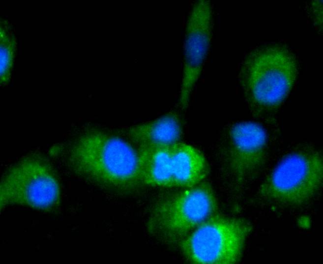 GAPDH Rabbit mAb