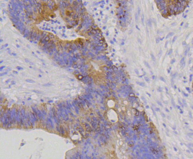 Cytokeratin 20 Rabbit mAb
