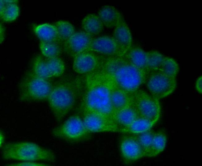 CD9 Rabbit mAb
