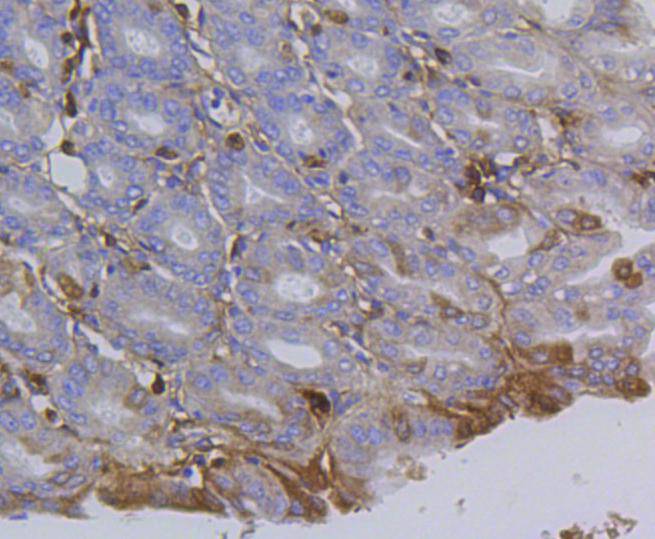 Integrin beta-1 Rabbit mAb