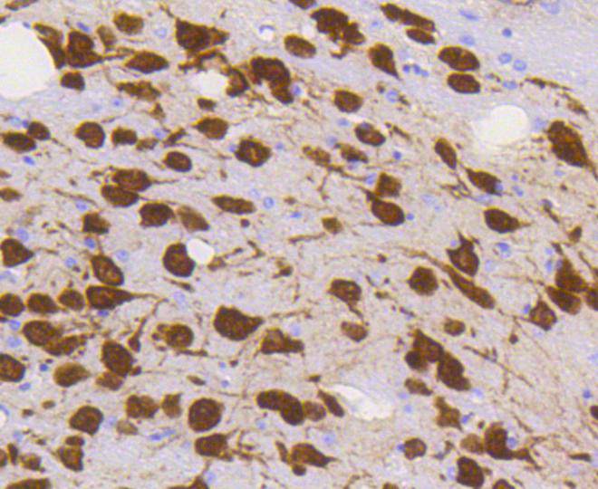 NeuN Rabbit mAb