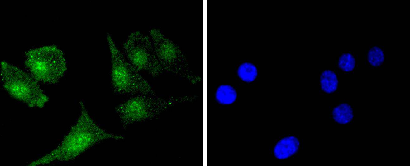 Bcl-2 Rabbit mAb