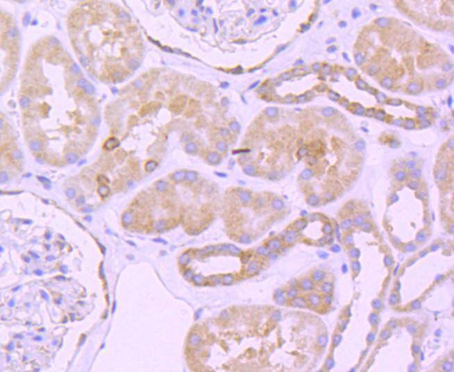 Bcl-2 Rabbit mAb