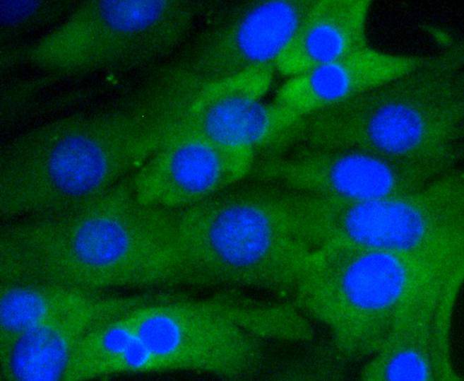 NF-kB p65 Rabbit mAb