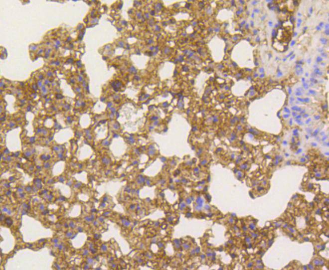 NF-kB p65 Rabbit mAb