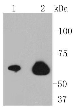 NF-kB p65 Rabbit mAb