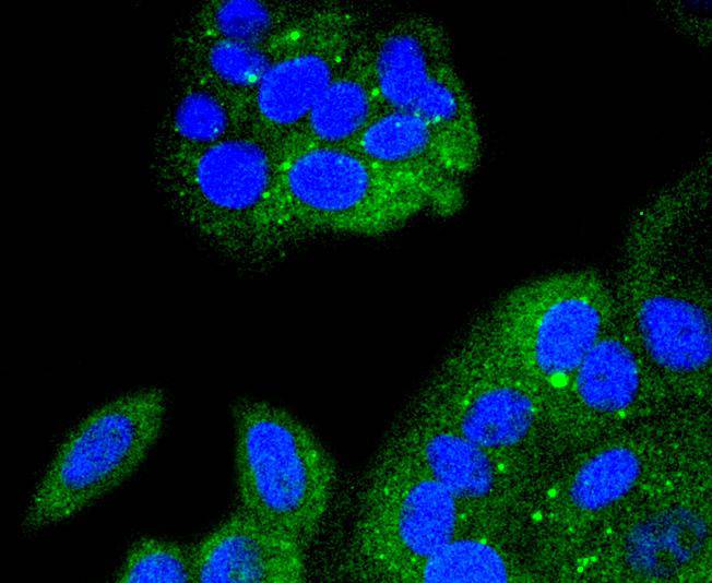 IKB alpha Rabbit mAb