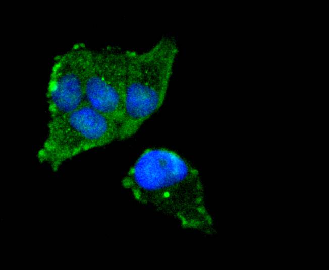 FOXO3A Rabbit mAb