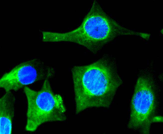 VEGF Rabbit mAb