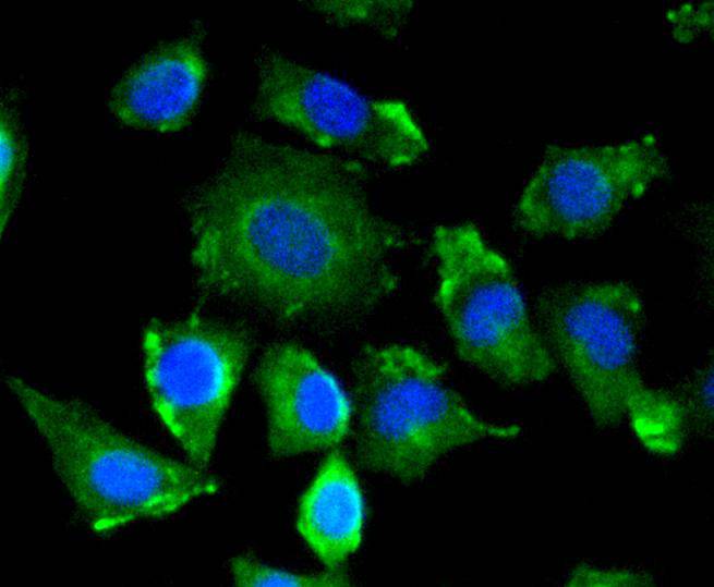 VEGF Rabbit mAb