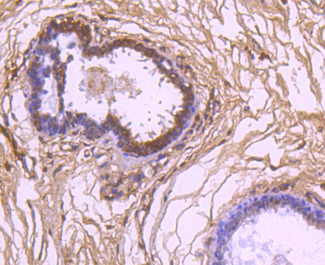 VEGF Rabbit mAb