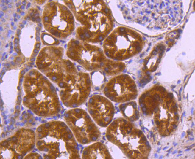 VEGF Rabbit mAb