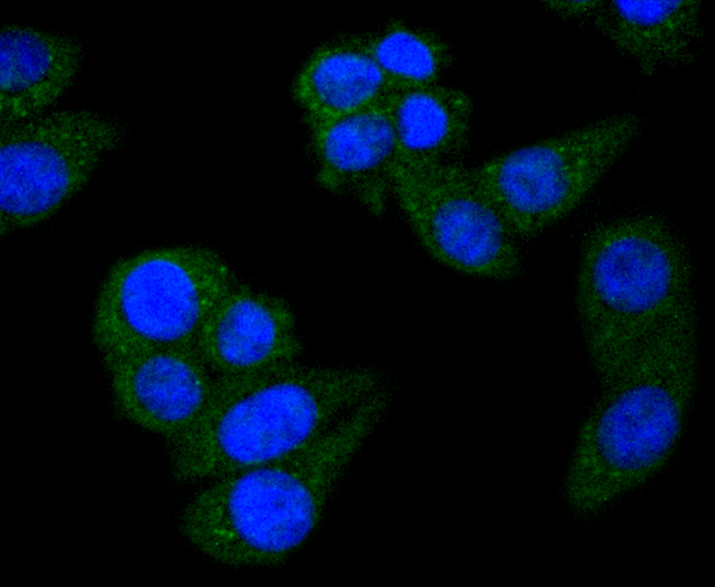 STAT6 Rabbit mAb