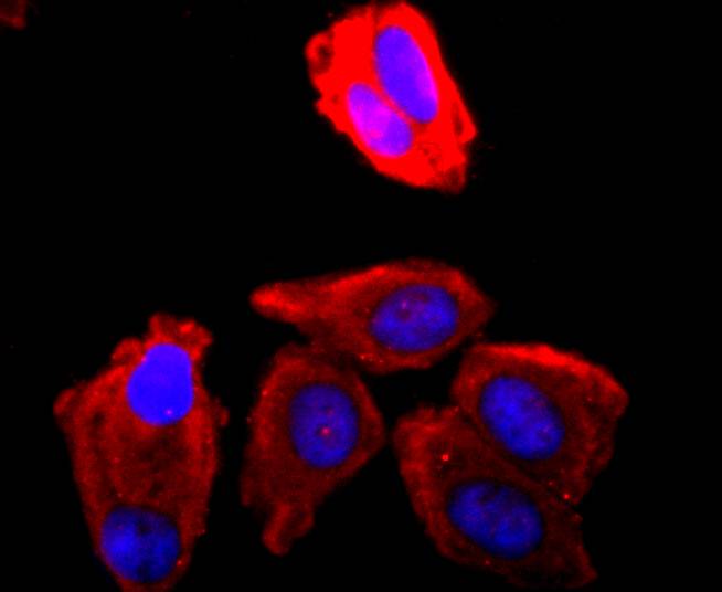 CDK1 Rabbit mAb