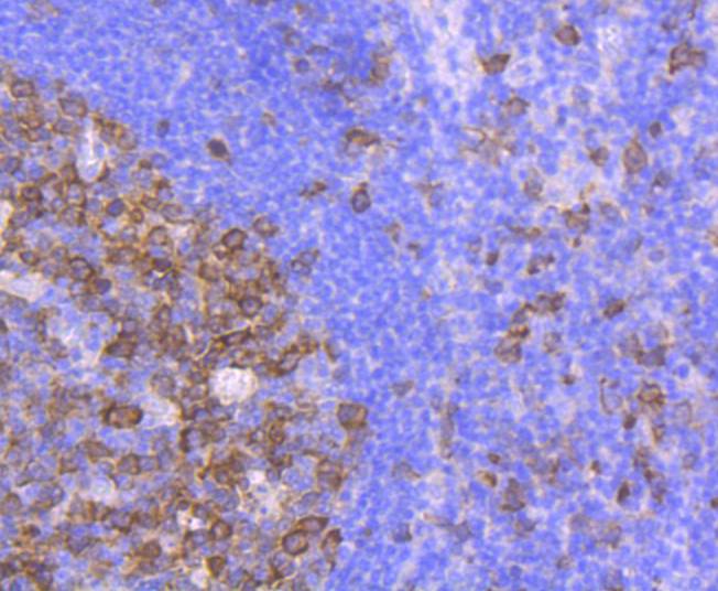 CDK1 Rabbit mAb