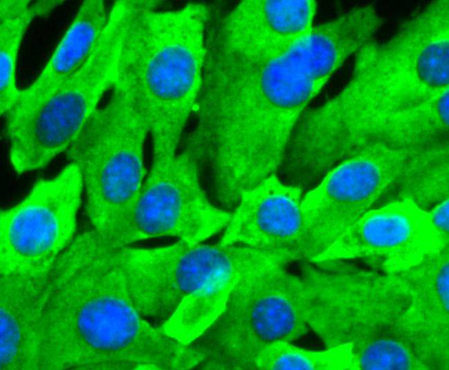 Hsp90 beta Rabbit mAb