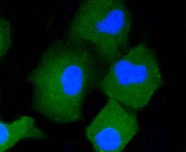 CD34 Rabbit mAb