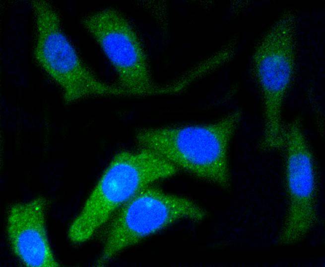 CD34 Rabbit mAb