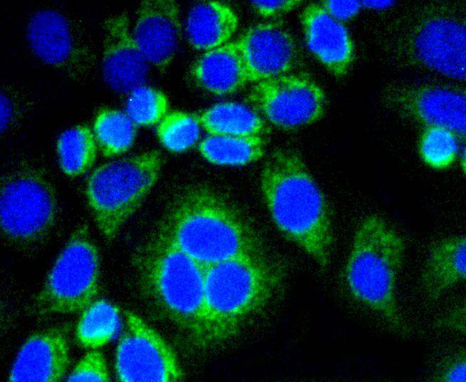 Calponin Rabbit mAb