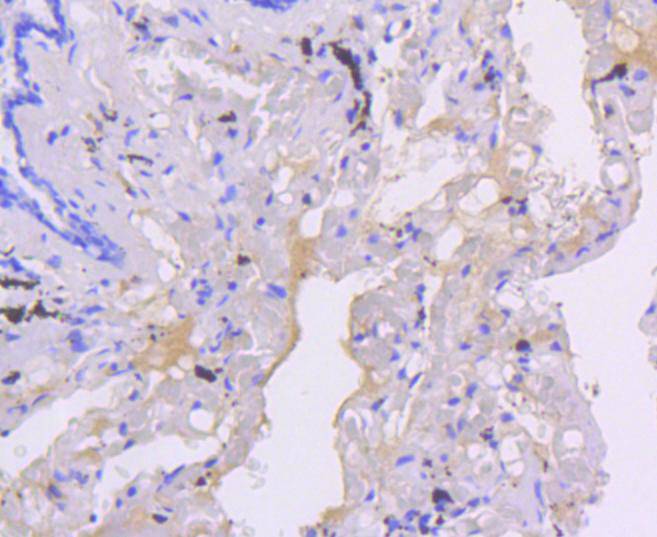 Smad5 Rabbit mAb