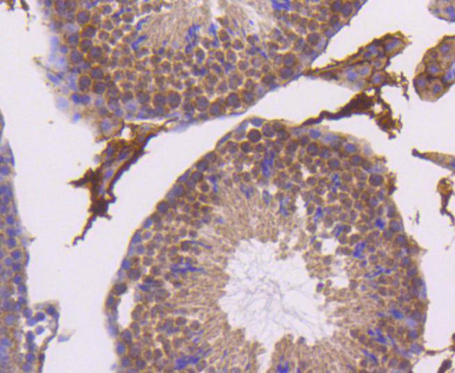 Smad5 Rabbit mAb