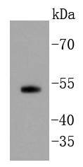 Smad5 Rabbit mAb