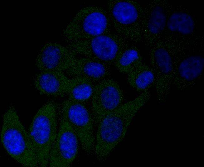 NGF Rabbit mAb