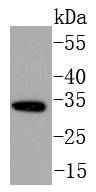 NGF Rabbit mAb