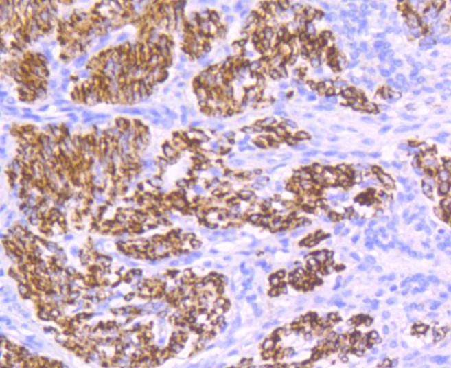 Desmin Rabbit mAb