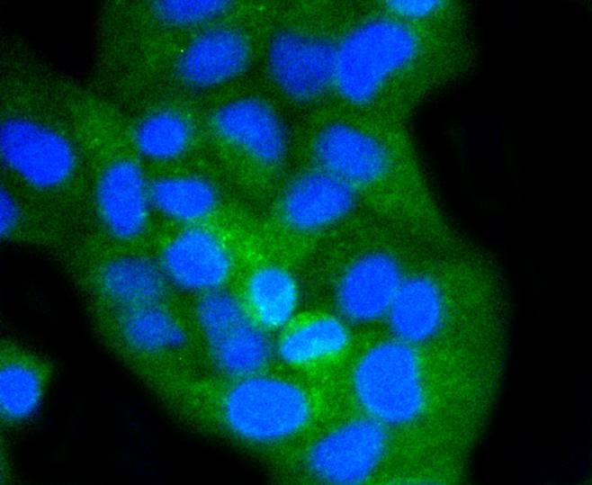 CD8 alpha Rabbit mAb