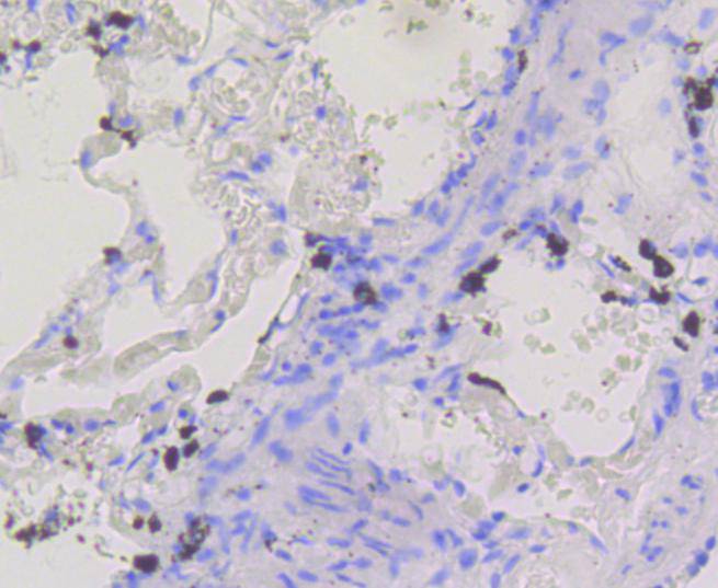 BDNF Rabbit mAb