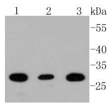 BDNF Rabbit mAb