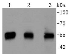 PTEN Rabbit mAb