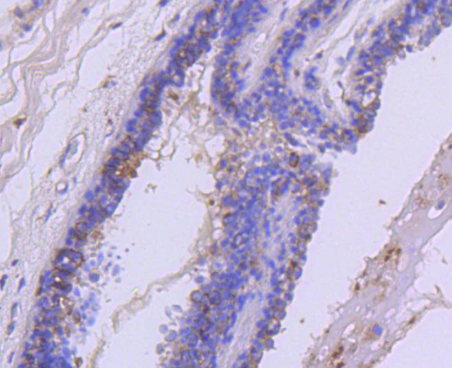 Met(C-Met) Rabbit mAb