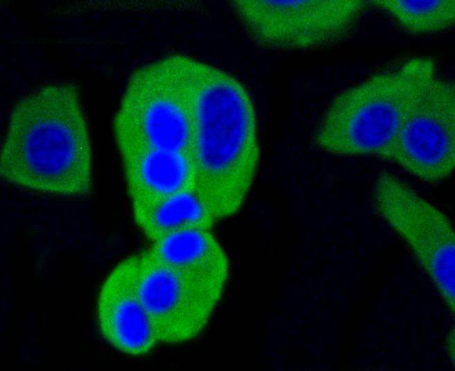 Calmodulin Rabbit mAb