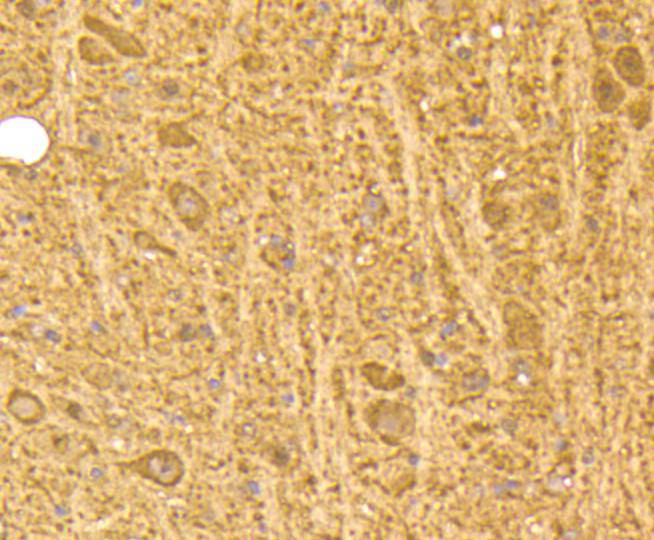 Calmodulin Rabbit mAb