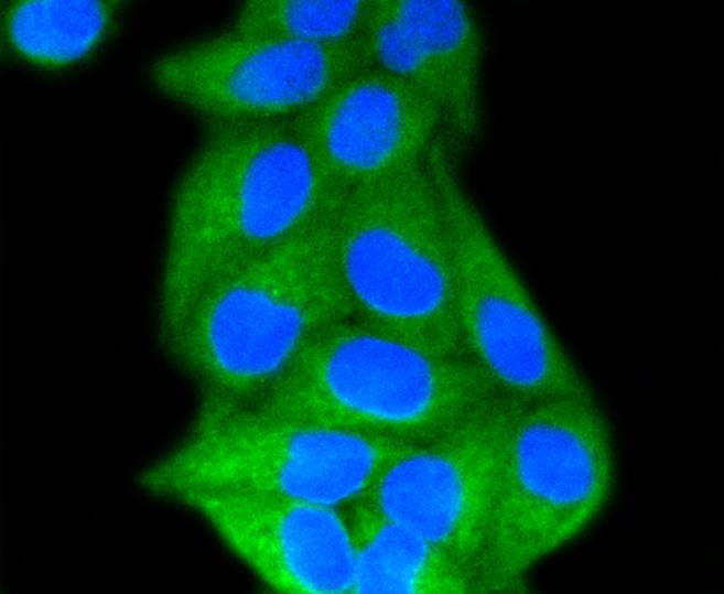 LDL Receptor Rabbit mAb