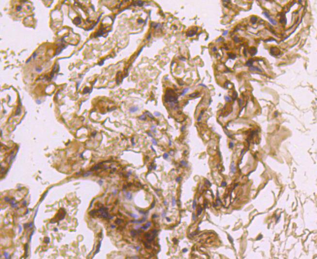 LDL Receptor Rabbit mAb