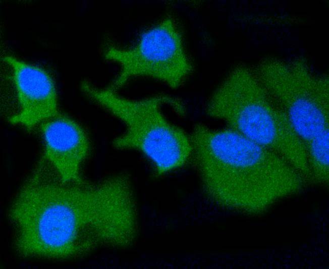 MMP14 Rabbit mAb