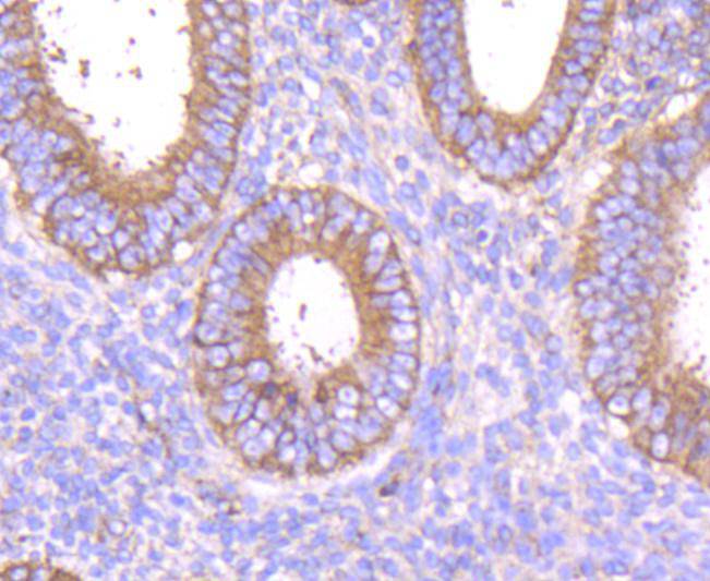 MMP14 Rabbit mAb