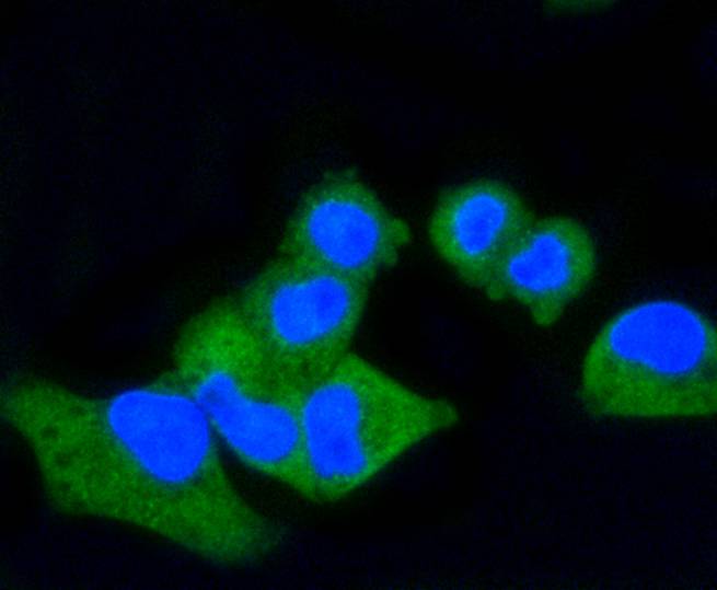 CD86 Rabbit mAb