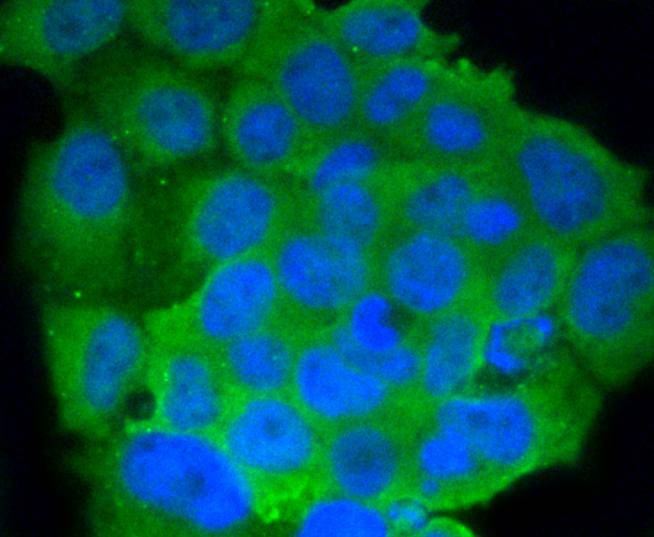 CD86 Rabbit mAb