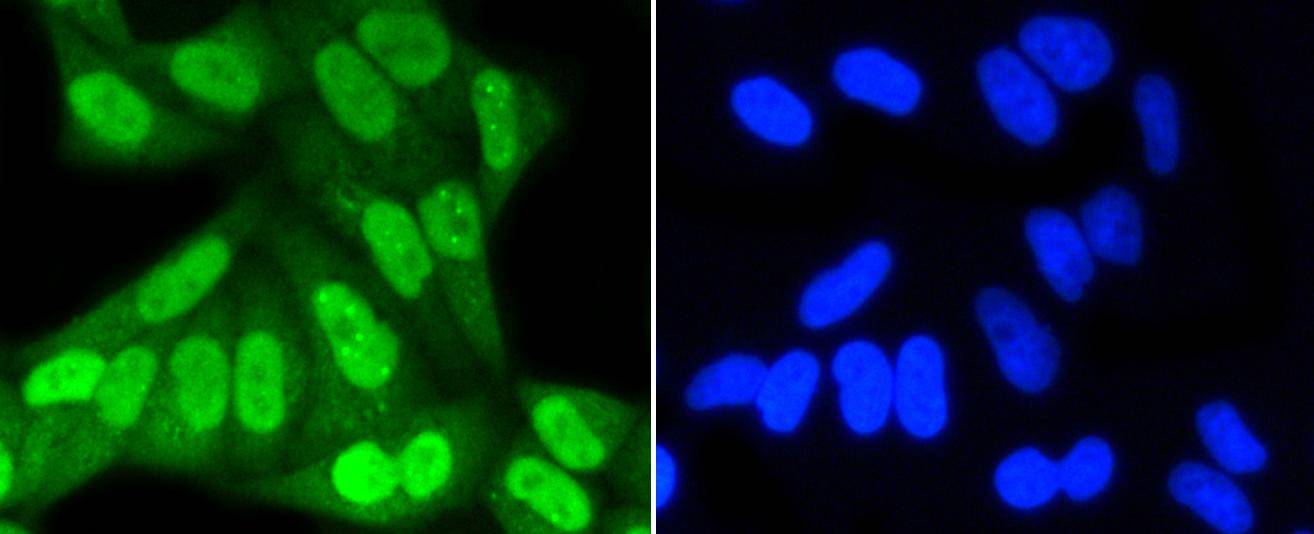 SUMO-1 Rabbit mAb