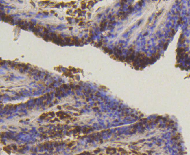 SUMO-1 Rabbit mAb