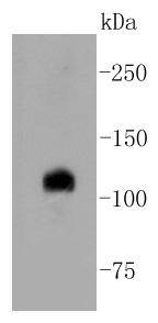 Notch 1 Rabbit mAb