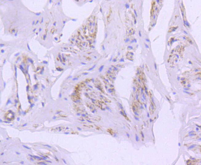 Caveolin-2 Rabbit mAb