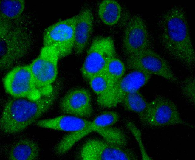 Paxillin Rabbit mAb