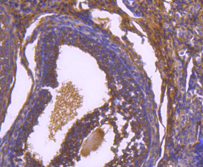 Paxillin Rabbit mAb