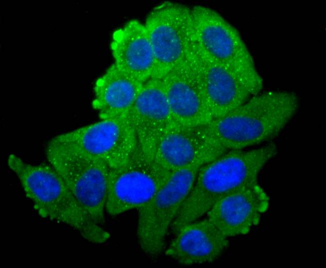 N Cadherin Rabbit mAb